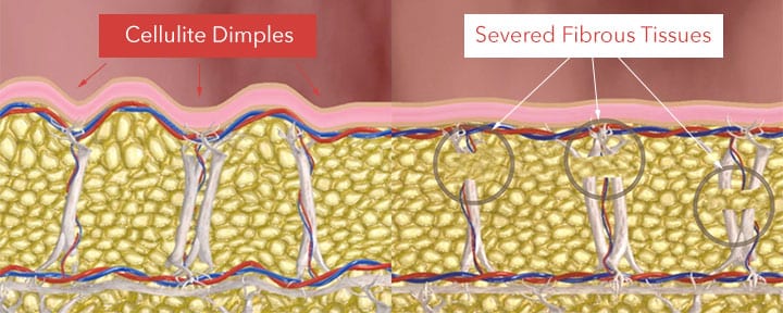 Fibrous Tissue Diagram